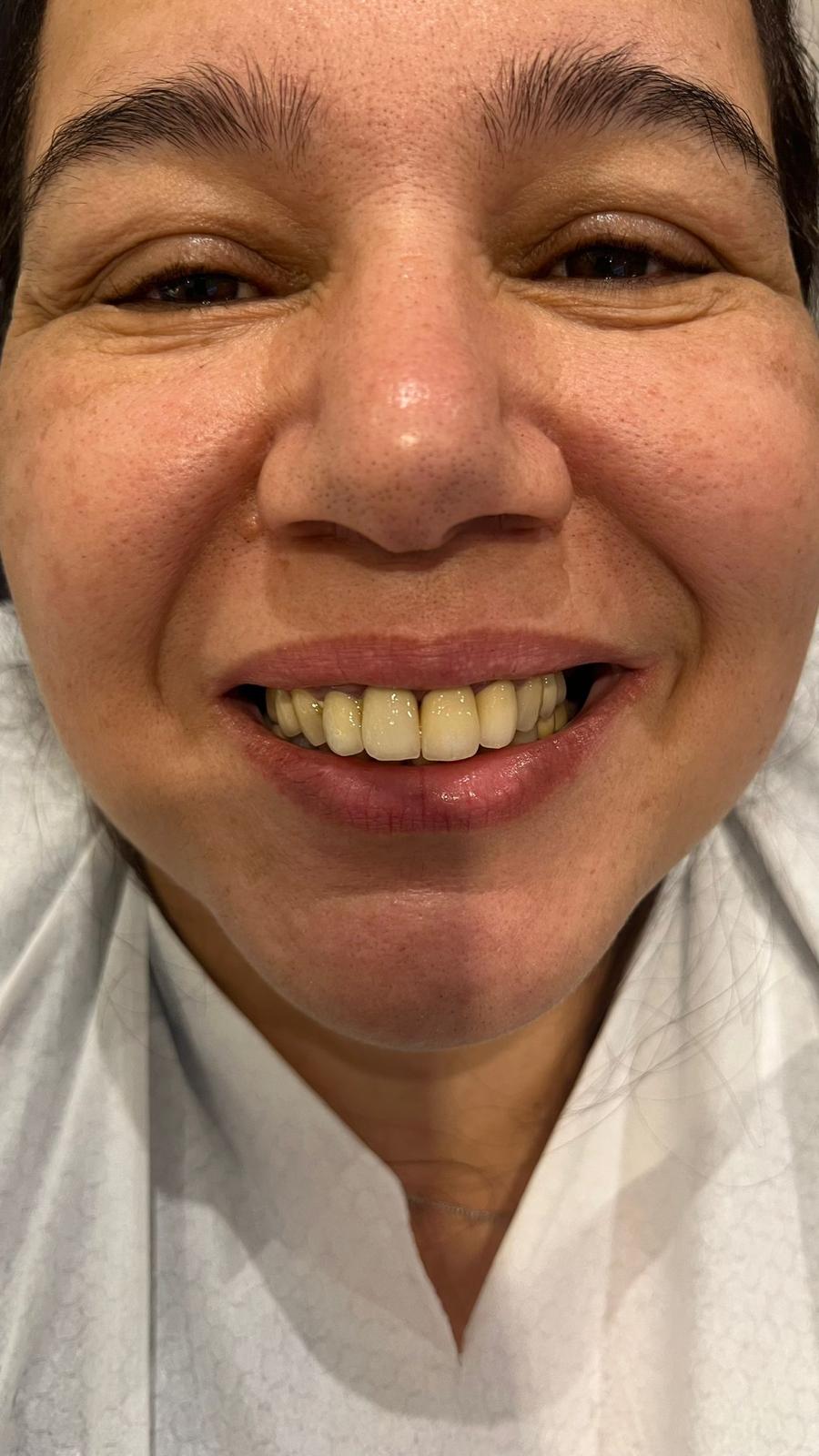 ECE Dental Patient Transformation